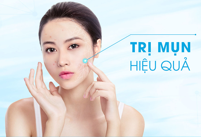 Phòng tránh và điều trị mụn trứng cá