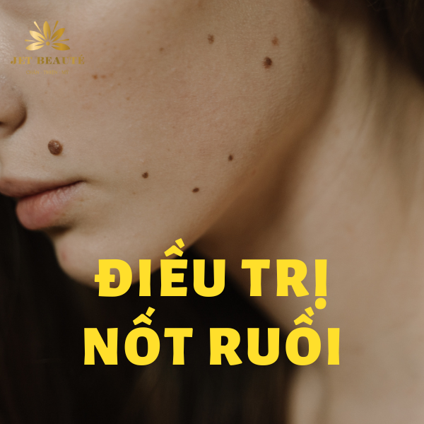 CHĂM SÓC DA SAU KHI XÓA NỐT RUỒI