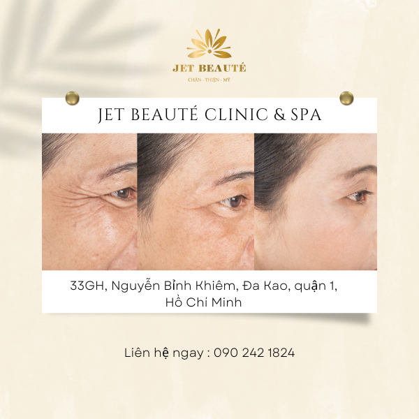 Các mốc tuổi LÃO HÓA của con người