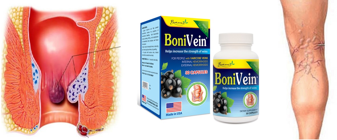 Bonivein Canada, hỗ trợ làm giảm các triệu chứng của bệnh trĩ Phuonglinh Store