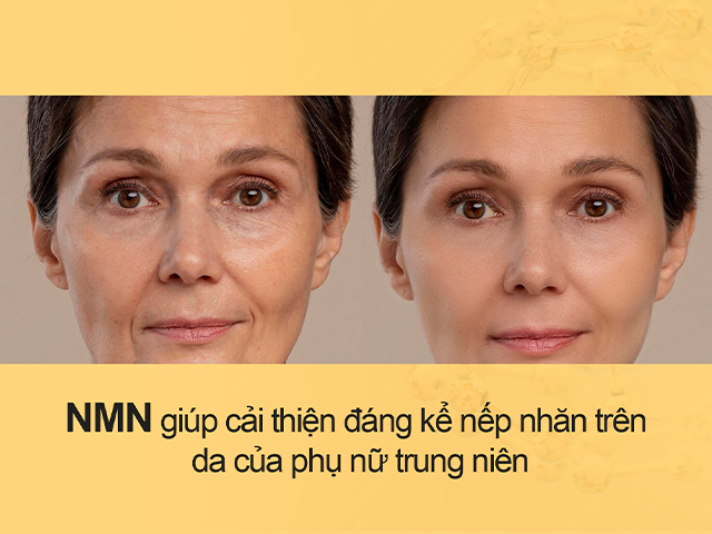 MỸ PHẨM NMN CHỈ LÀ “HOT TREND” HAY THẬT SỰ CÓ HIỆU QUẢ? MỸ PHẨM NMN CHỈ LÀ “HOT TREND” HAY THẬT SỰ CÓ HIỆU QUẢ?