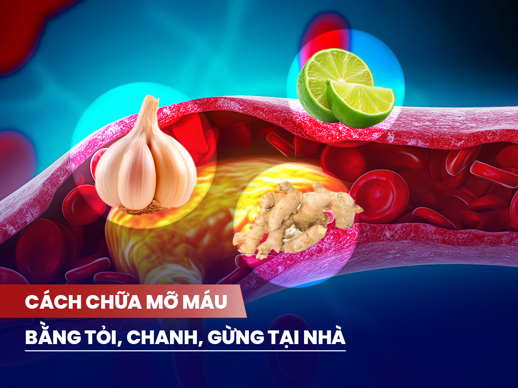 CÁCH CHỮA MỠ MÁU BẰNG TỎI, CHANH, GỪNG TẠI NHÀ CÁCH CHỮA MỠ MÁU BẰNG TỎI, CHANH, GỪNG TẠI NHÀ