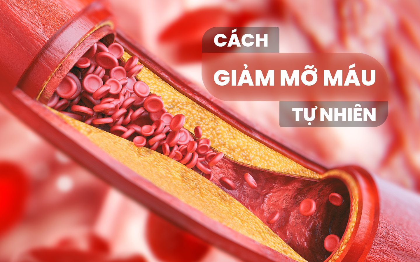 Cách giảm mỡ máu tự nhiên