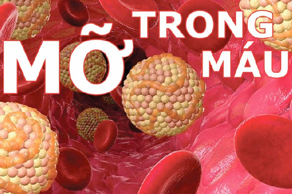 8 Nguyên nhân gây máu nhiễm mỡ hàng đầu 8 Nguyên nhân gây máu nhiễm mỡ hàng đầu