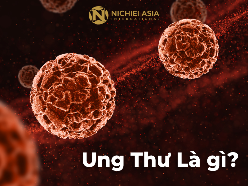 Ung Thư Tuy Khó Chữa – Nhưng Có Thể Phòng Ngừa