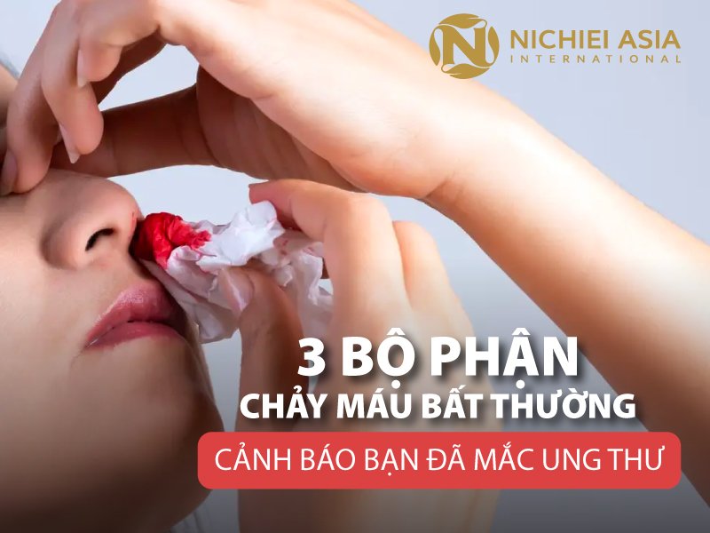 3 Bộ Phận Chảy Máu Bất Thường Cảnh Báo Bạn Đã Mắc Ung Thư