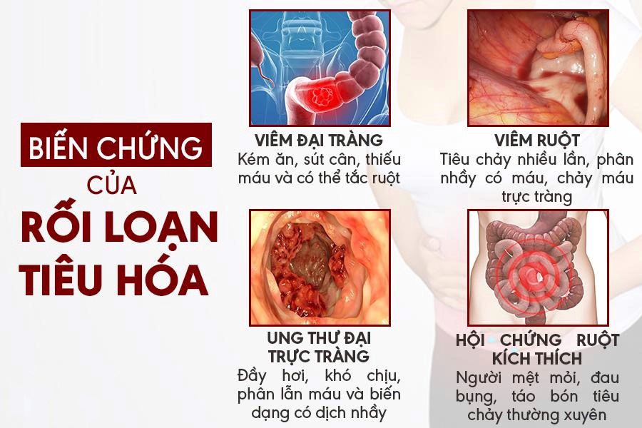 Nguyên Nhân Và Triệu Chứng Điển Hình Của Bệnh Rối Loạn Tiêu Hóa Nguyên Nhân Và Triệu Chứng Điển Hình Của Bệnh Rối Loạn Tiêu Hóa