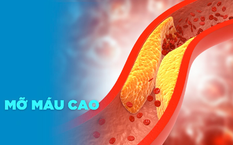 Mỡ máu là gì?