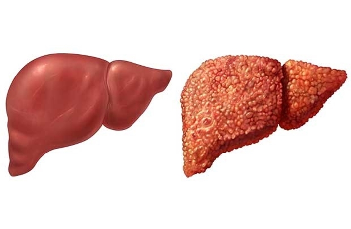 Thực phẩm chức năng mát gan giải độc