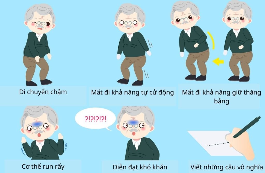 Biểu hiện của bệnh Parkinson
