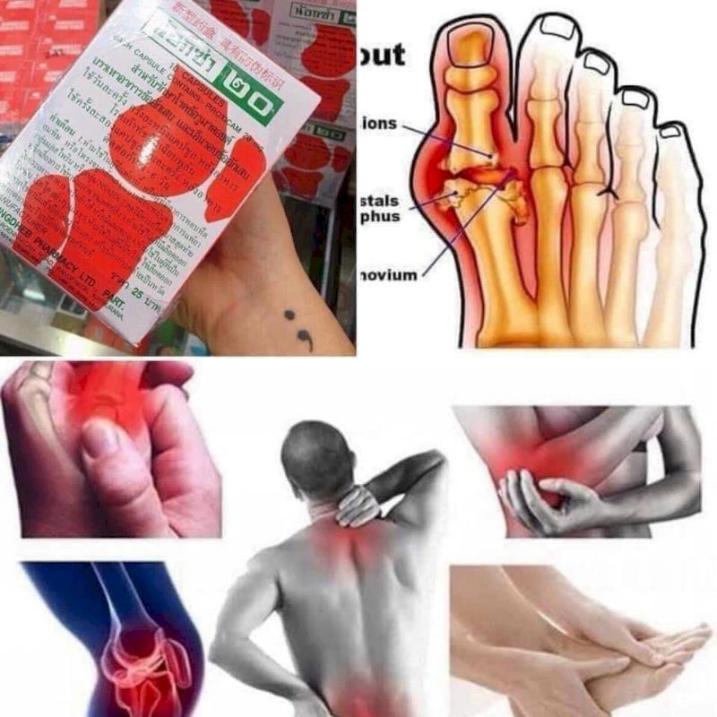 Các trường hợp chống chỉ định dùng thuốc noxa 20 Thái