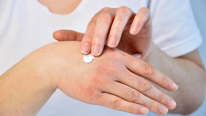 Khám phá cơ chế hoạt động của thuốc xoa bóp giảm đau xương khớp của Nhật