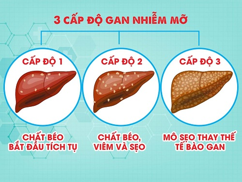 Bệnh Gan Nhiễm Mỡ: Hiểu Rõ Về Vấn Đề và Giải Pháp