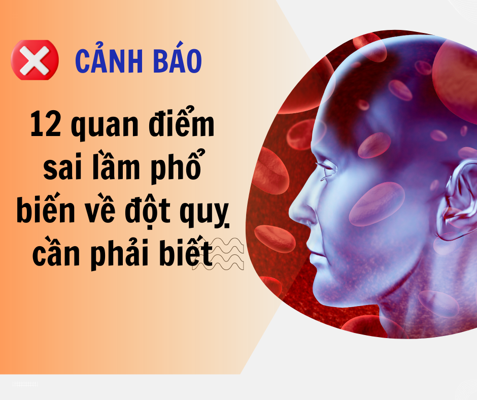 12 Quan Điểm Sai Lầm Về Đột Quỵ Bạn Cần Hiểu Để Bảo Vệ Sức Khỏe