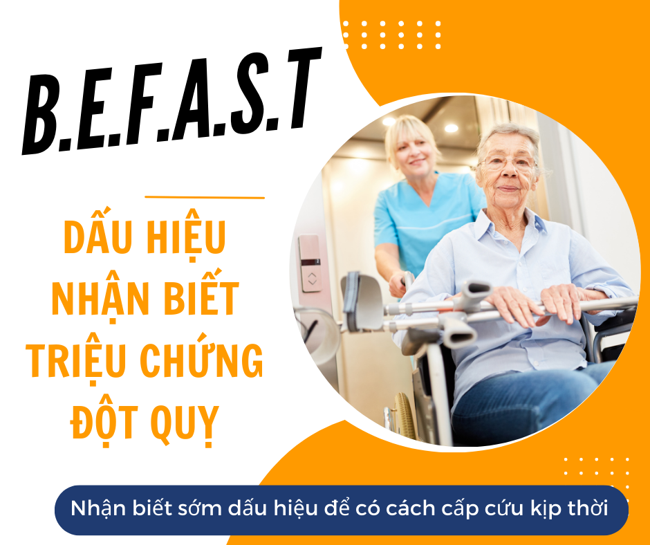 Quy tắc B.E. FAST để nhận ra sớm các dấu hiệu đột quỵ