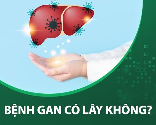 Bệnh gan có lây không? Cách phòng bệnh an toàn