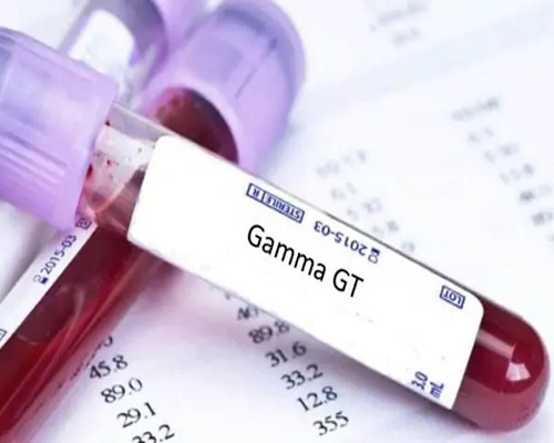 Chỉ số GGT bao nhiêu là bình thường và những yếu tố làm tăng men gan
