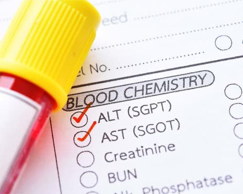 Chỉ số GOT là gì? Phân biệt GOT và GPT trong xét nghiệm gan