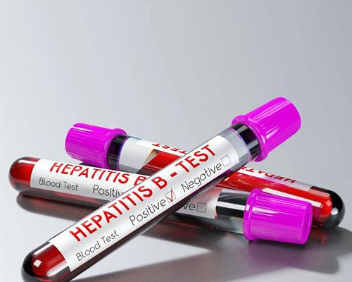 Chỉ số HBsAg bao nhiêu là nguy hiểm và 4 dấu hiệu cảnh báo tổn thương gan