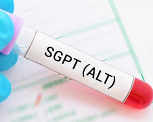 Chỉ số SGPT là gì? 3 mức độ cảnh báo tổn thương gan cần biết