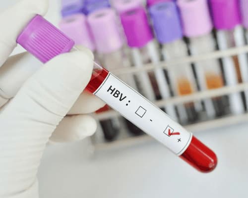 Định lượng HBV bao nhiêu là bình thường?