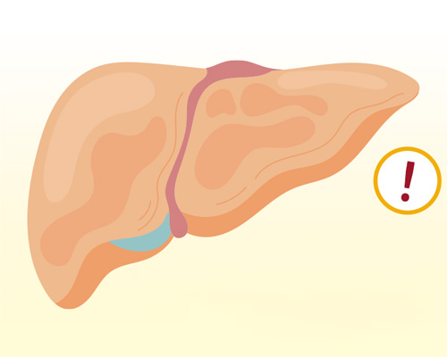 Gan bị nhiễm độc phải làm sao? Cách chăm sóc tại nhà và khi nào cần đi khám