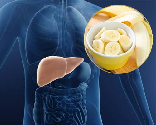 Sự thật gan nhiễm mỡ ăn chuối được không? 3 lưu ý quan trọng