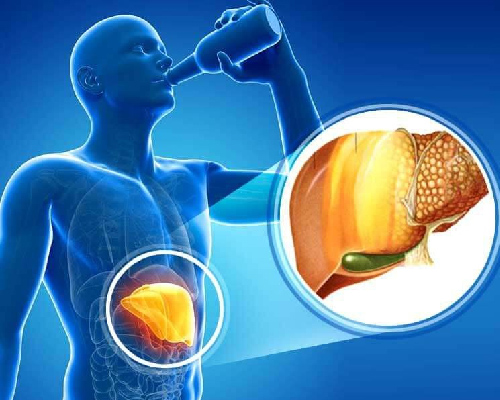 Gan nhiễm mỡ độ 4 có nguy hiểm không?