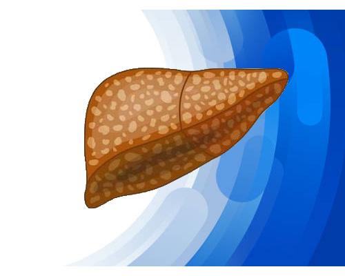 Gan nhiễm mỡ không đều là gì? Những điều cần biết