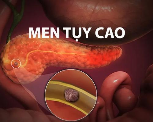 Men tụy cao có nguy hiểm không?