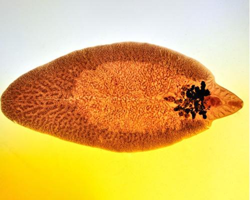 Sán lá gan gây bệnh gì? Cách nhận biết và phòng tránh