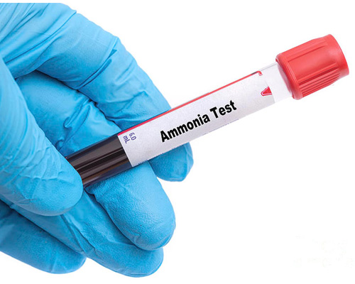 Tìm hiểu thuốc điều trị duy trì tăng amoniac máu