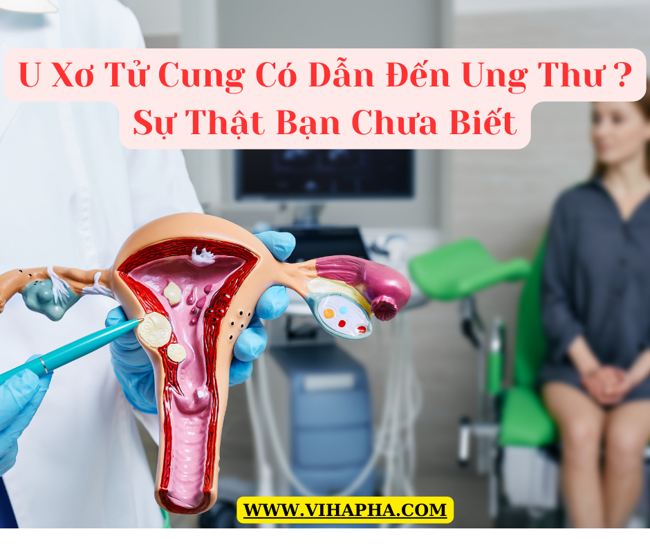 U XƠ TỬ CUNG CÓ DẪN ĐẾN UNG THƯ KHÔNG? SỰ THẬT BẠN CHƯA BIẾT