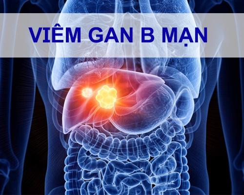 Viêm gan B mạn là gì, có chữa được không?