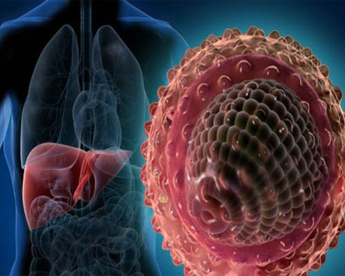 Viêm gan cấp tính là gì? Nguyên nhân, triệu chứng bệnh