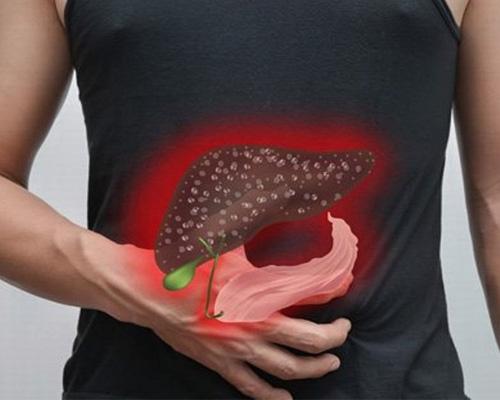 Xơ gan ứ mật nguyên phát là gì?