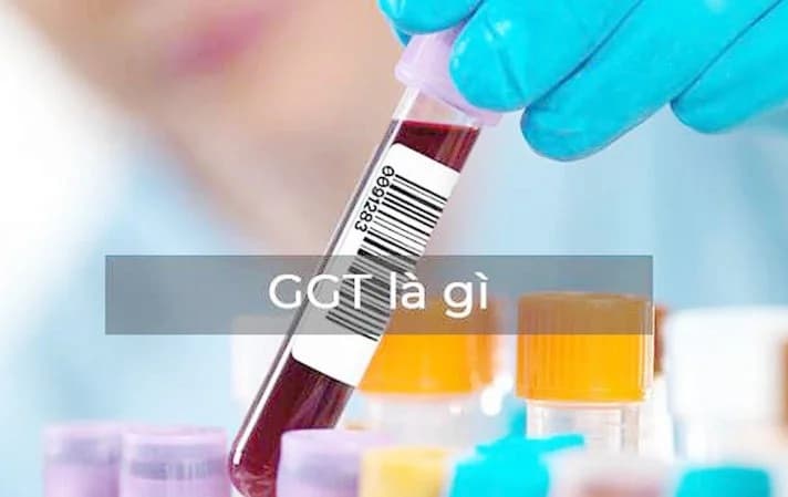 Chỉ số GGT là gì?