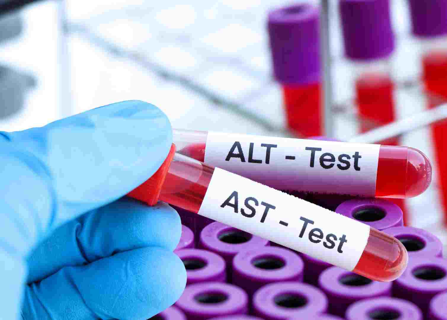 Chỉ sổ xét nghiệm gan