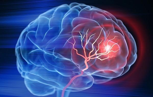 Cơn thiếu máu não