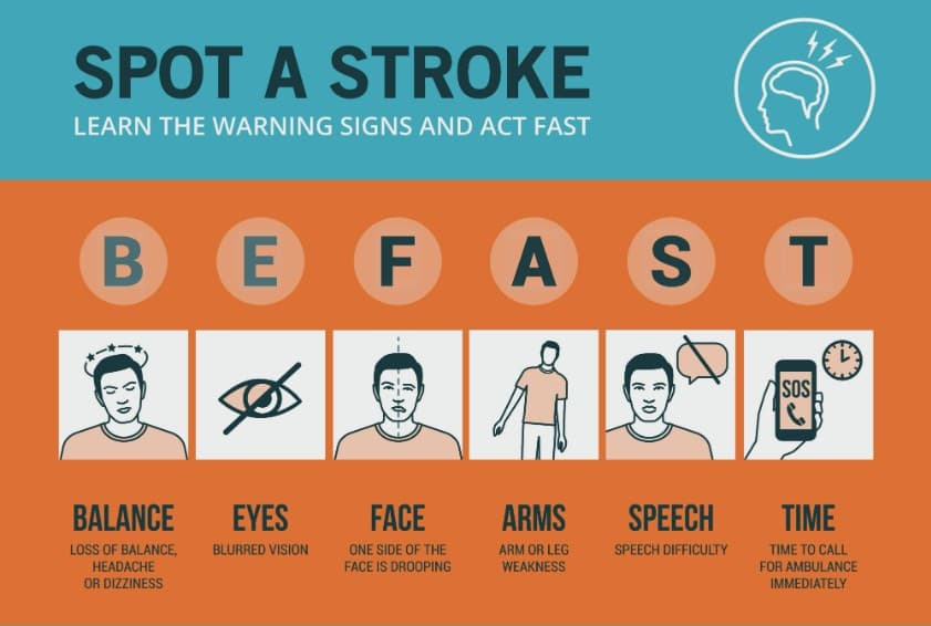 Dấu hiệu đột quỵ ở người trẻ 