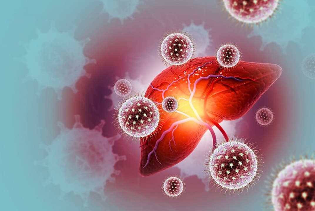 Men gan cao có nguy hiểm không