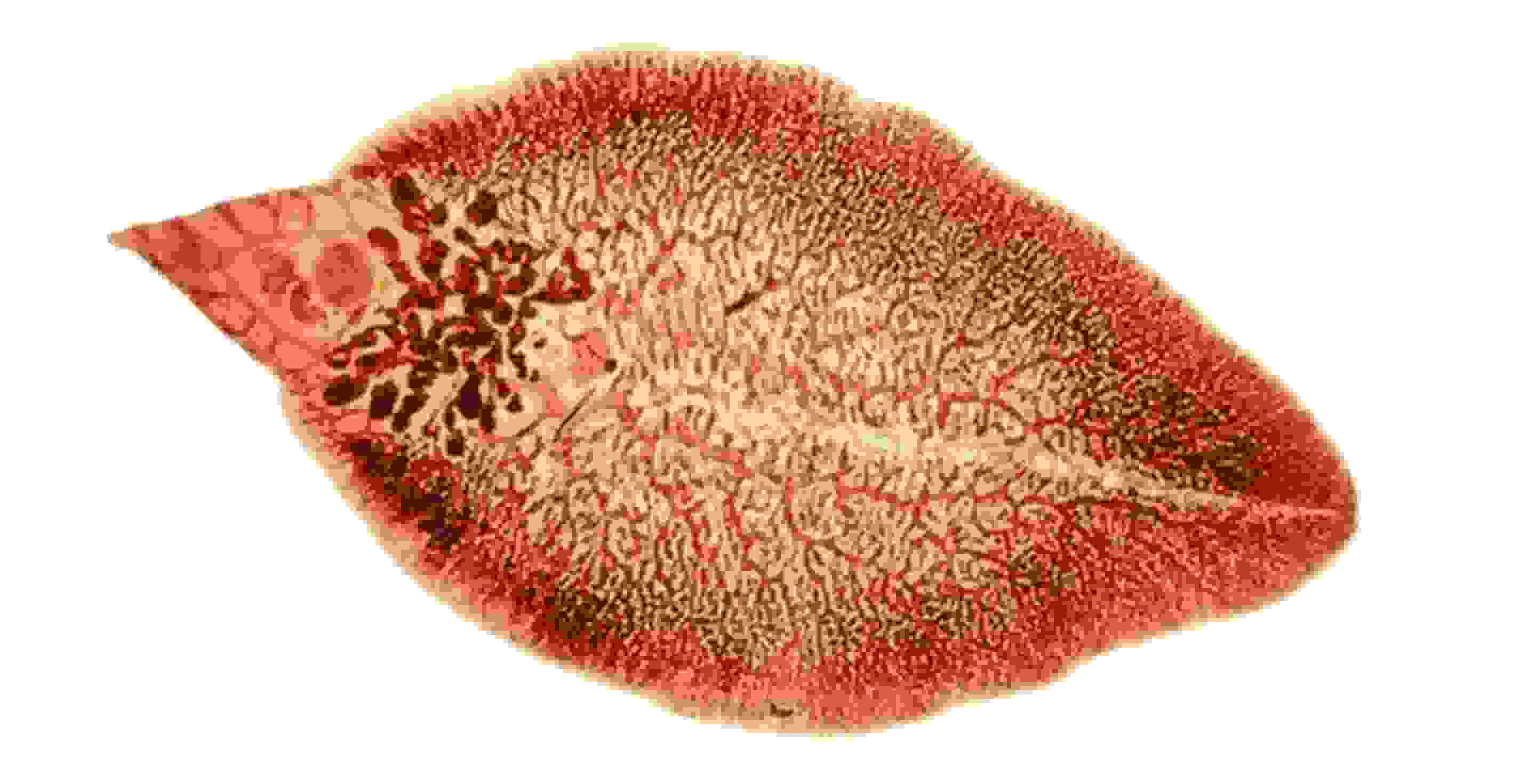 Sán lá gan là gì