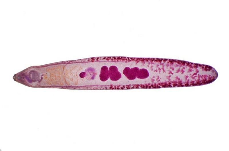 Sán lá gan nhỏ là bệnh gì