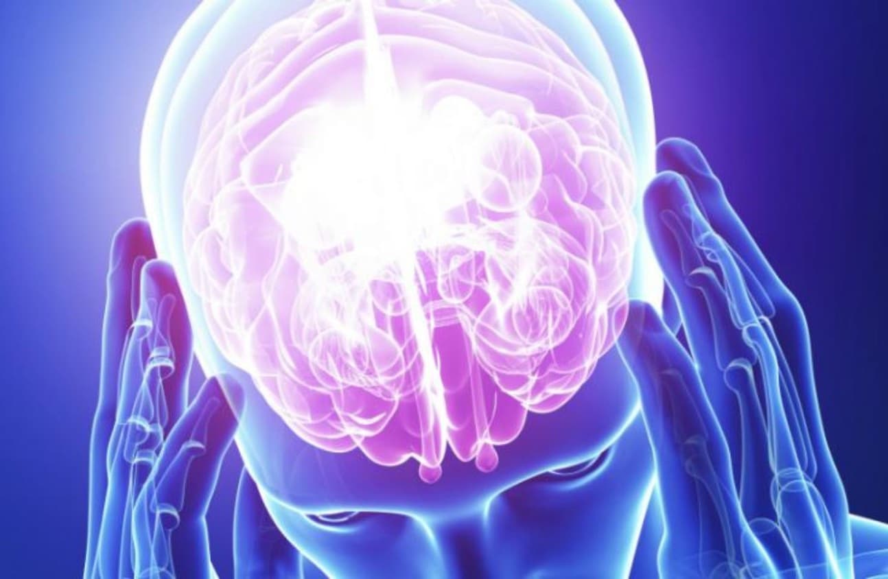 Thiếu máu não cục bộ