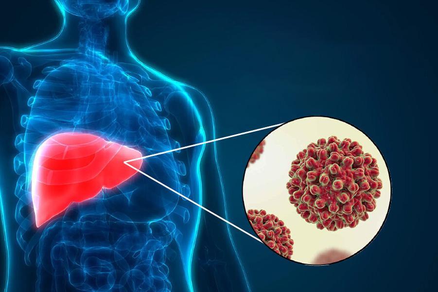 Viêm gan B thể ngủ là gì 