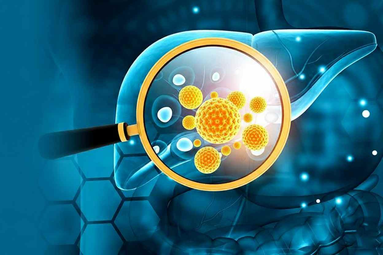 Tìm hiểu viêm gan virus mạn