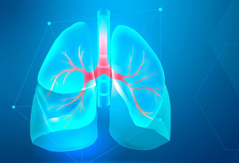 Viêm phế quản cấp