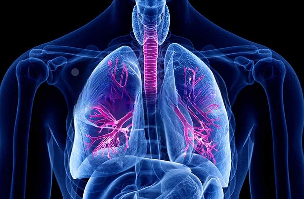 Viêm phế quản là gì?