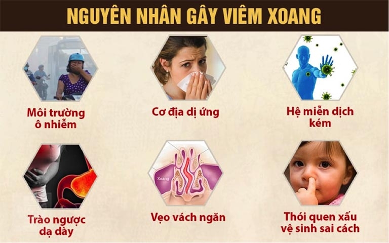 Viêm xoang: Nguy hiểm không chỉ là nghẹt mũi