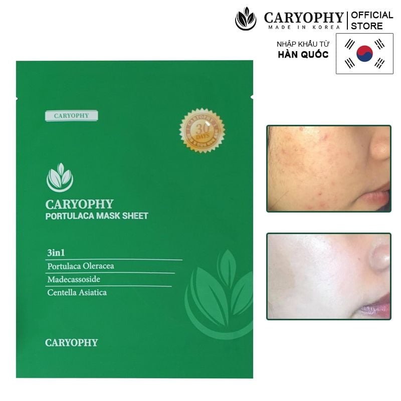 Mặt Nạ Miếng Caryophy Làm Dịu, Hỗ Trợ Phục Hồi Dành Cho Da Dầu Mụn Portulaca Mask Sheet 22g